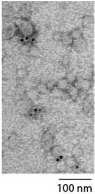 Systemic Mesenchymal Stem Cell-Derived Exosomes Reduce Myocardial Infarct Size: Characterization With MRI in a Porcine Model